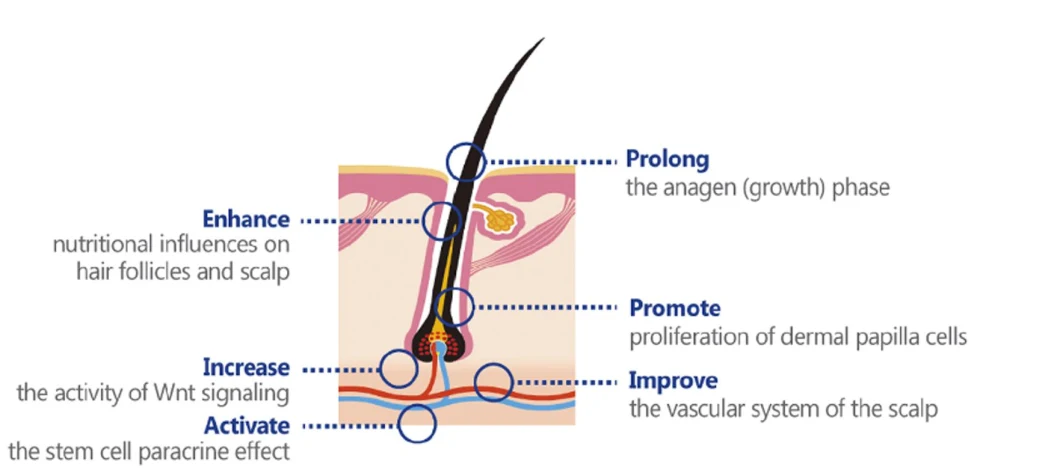 Aape Promotes Hair Growth Anti Hair Loss to Grow Hair for Alopecia Aape