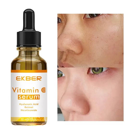 Siero viso biologico anti-età per la cura della pelle, vitamina C, retinolo, acido ialuronico